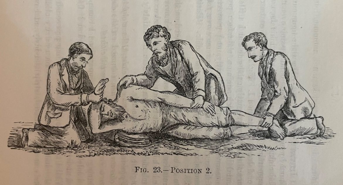 An illustration of a method of resuscitation.